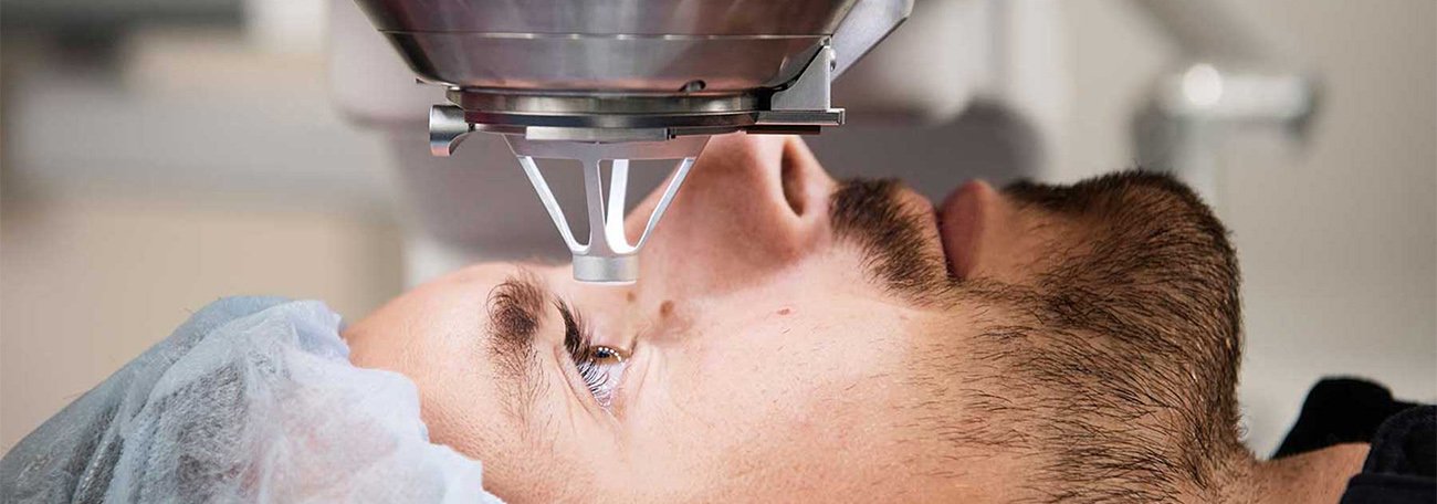 Laser Lasik